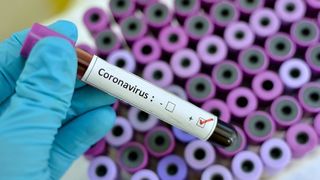Coronavirus - O mie de persoane sunt izolate la domiciliu, &icirc;n Rom&acirc;nia. Alte 17 sunt &icirc;n carantină