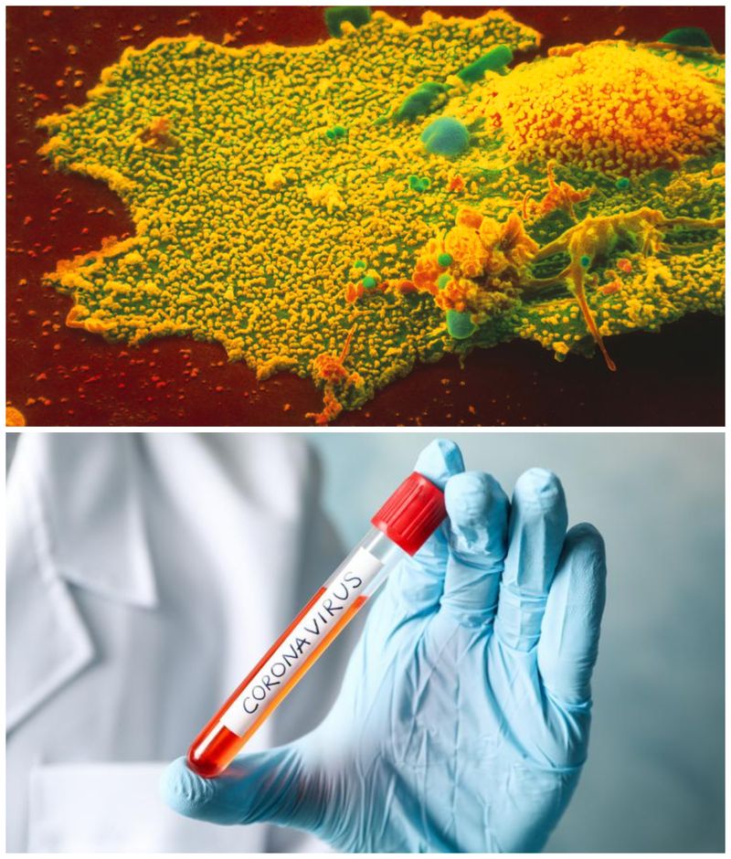 coronavirus spania cazuri confirmate