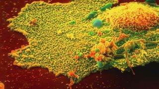 Coronavirus Romania italian Craiova