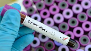 Coronavirus &icirc;n Rom&acirc;nia