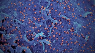 Numărul cazurilor active de infectare cu coronavirus a ajuns la 30 &icirc;n Spania. Autorităţile avertizează că panica poate duce la colapsul sistemului sanitar