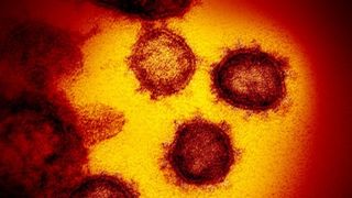Coronavirus. Cum arată văzut la microscop virusul ucigaș