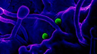 VIDEO | Coronavirus - Italia a depăşit cifra de 10.000 de persoane diagnosticate pozitiv. 168 de morţi &icirc;ntr-o zi