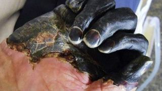 Ciuma sau &bdquo;Moartea neagră&rdquo; lovește Rom&acirc;nia sub formă de CORONAVIRUS