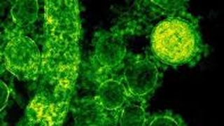 Femeie suspectă de COVID-19 la Buzău