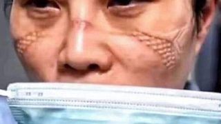 Ei sunt medicii care tratează pacienții infectați cu CORONAVIRUS