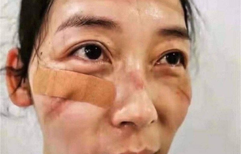 Ei sunt medicii care tratează pacienții infectați cu CORONAVIRUS