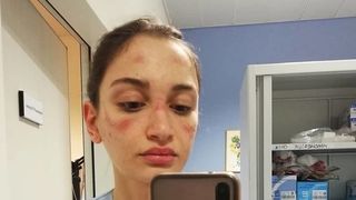 Ei sunt medicii care tratează pacienții infectați cu CORONAVIRUS. Vezi chinurile la care sunt suspuși: „Timp de 6 ore nu pot să bea apă, să mănânce și să meargă la baie”