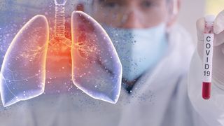 Orban: Poveştile că mergem din uşă în uşă să facem teste nu sunt serioase