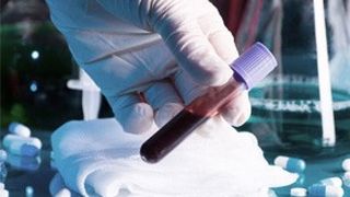 VIDEO | Coronavirus. Bucureştenii vor intra, p&acirc;nă la urmă, &icirc;ntr-un proiect pilot de testare