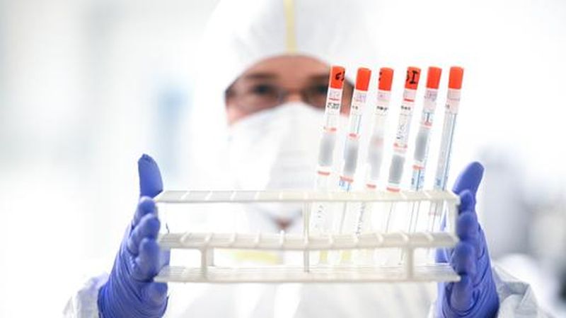 Cântăreață din România răpusă de coronavirus