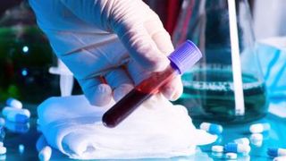 Tătaru: V&acirc;rful epidemiei de coronavirus, la jumătatea lui aprilie