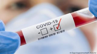 Covid-19 &icirc;n Spania - Cel mai mic număr de decese zilnice &icirc;nregistrat &icirc;n ultima săptăm&acirc;nă