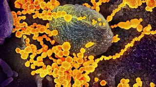 Adevărul despre coronavirus: Este sau nu un virus creat &icirc;n laborator?