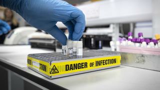 Covid-19 este mai mult dec&acirc;t o pneumonie: "Maladia poate afecta vasele sanguine ale tuturor organelor" - studiu