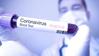 Studiu: O persoană din cinci infectată cu Covid-19 nu prezintă simptome