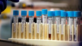 Coronavirusul a mai ucis 11 rom&acirc;ni. Bilanţul morţilor ajunge la 1.000