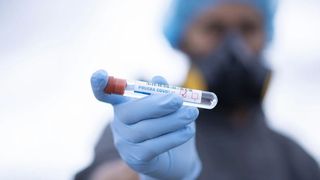 Coronavirus în Italia - Au fost raportate 1.402 de noi cazuri active şi 172 de decese