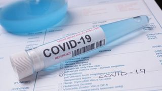 Slovenia, prima ţară din UE care afirmă că a &icirc;nvins epidemia covid-19