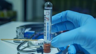 Bilanţul covid-19 în Spania creşte cu 56 de morţi şi 1.787 de contaminări