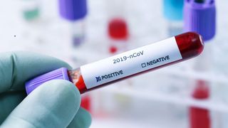 &Icirc;ncă trei decese cauzate de coronavirus . Bilanţul a ajuns la 1.210