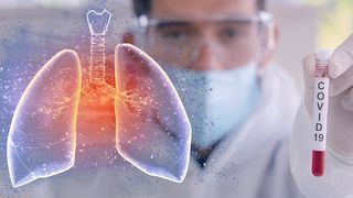 ue materiale protecție covid