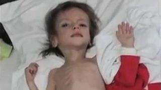 Transformarea Florentinei, copila hrănită p&acirc;nă la 4 ani doar cu pufuleți! A fost salvată de la moarte &icirc;n urmă cu 6 ani, iar acum este o adolescentă superbă