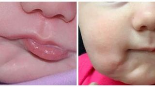 copilul cu două guri