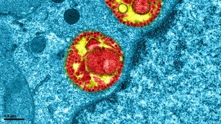 Studiu: O mutație prezentă la coronavirus crește semnificativ infectarea celulelor