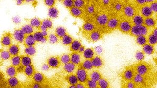 Virusul West Nile Romania