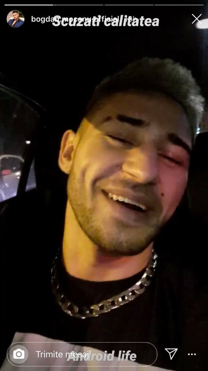 bogdan mocanu probleme cu pielea