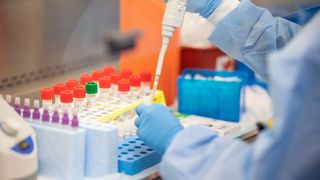 Descoperire şocantă privind COVID-19