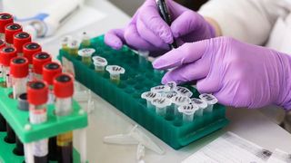 Sibiu: 30% dintre pacienţii care au primit plasmă au reuşit să &icirc;nvingă infecţia cu COVID-19