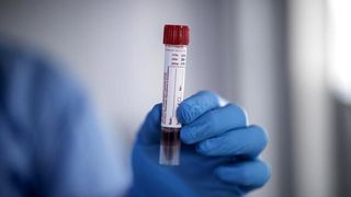 Şefa Departamentului Epidemiologic de la DSP Buzău, infectată cu COVID-19