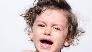 Numărul de cazuri de rujeolă din Rom&acirc;nia