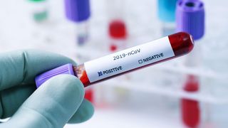 Avertismentul unui expert german cu privire la valul 2 de COVID-19. ”Cu cât aerul e mai uscat și rece, riscurile cresc”