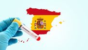 cazuri-coronavirus-spania