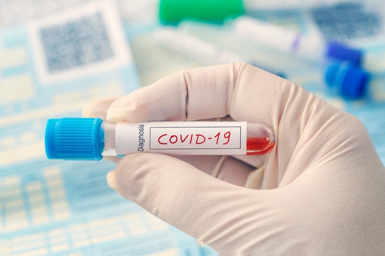 proba de sange coronavirus