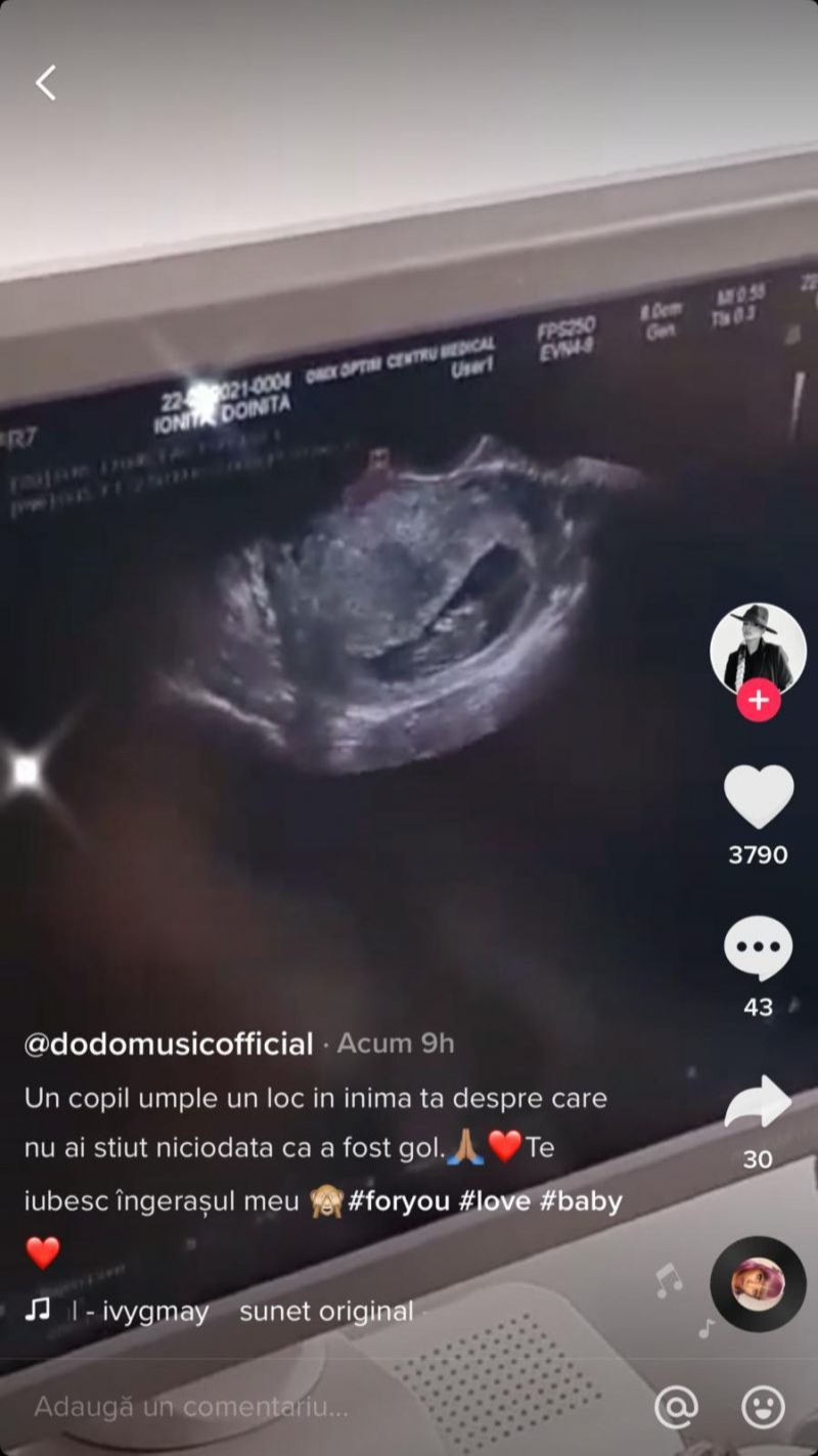 dodo copil ecografie