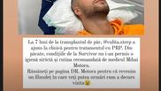 culita sterp implant de par