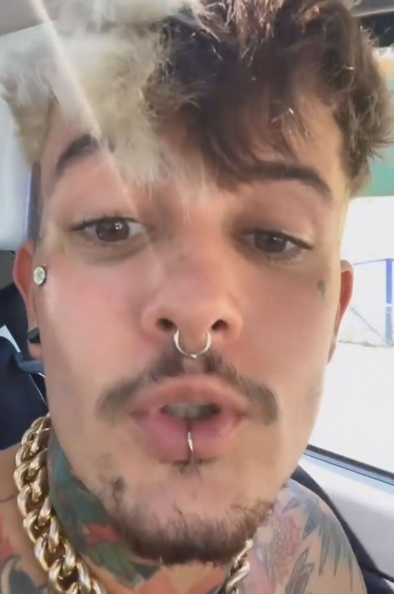 Zanni, c&acirc;știgătorul Survivor Rom&acirc;nia 2021, apariție neașteptată cu ochiul &icirc;nvinețit! &bdquo;M-au umflat haterii care nu voiau sa castig Survivor...&rdquo;