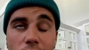 Justin Bieber suferă de sindromul Ramsay Hunt