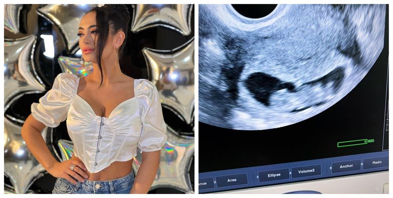 „Avem un bebe de trei lunițe”.  Artista Seya este însărcinată