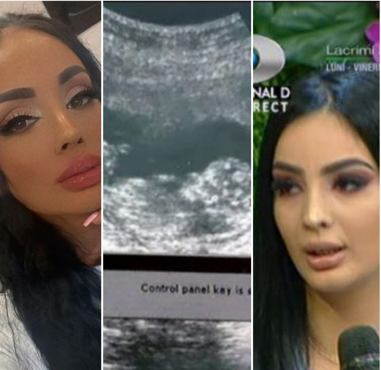 „Mai vrei un bebe?” Ce a răspuns Simina Loica, după ce a fost întrebată dacă s-ar mai vedea mama