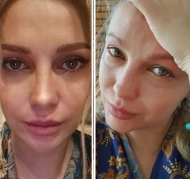 ,,Mi-am făcut analize”. Lora, probleme de sănătate. Ce diagnostic a primit artista