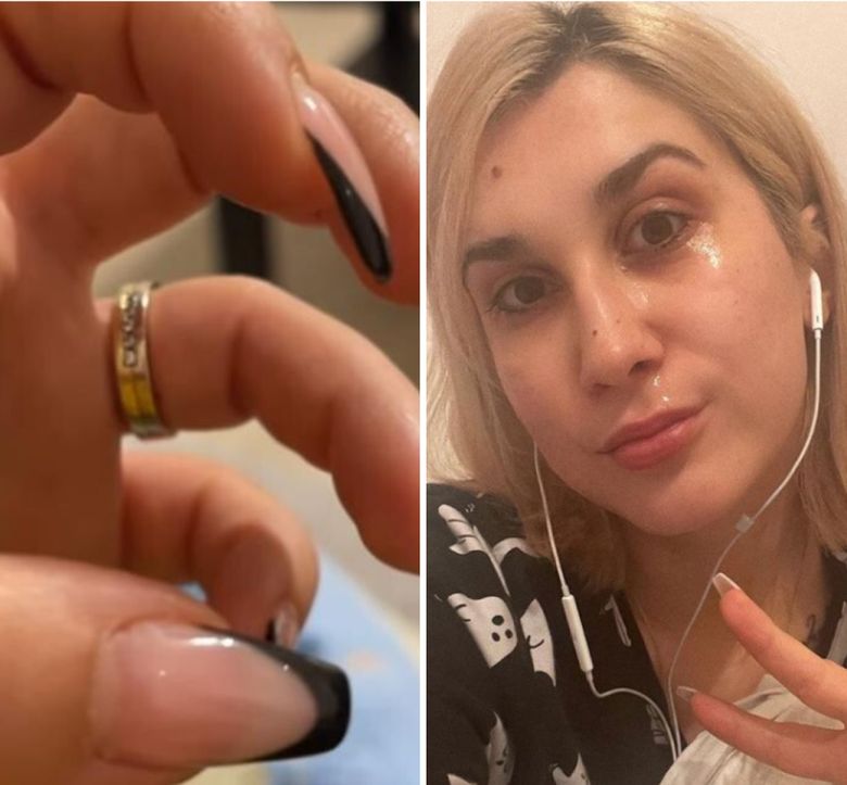 ,,Boala Borrelia nu vine singură.” Adda a aflat că are două chisturi pe creier. Ce declarații a făcut vedeta