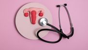 Ce înseamnă endometrioza