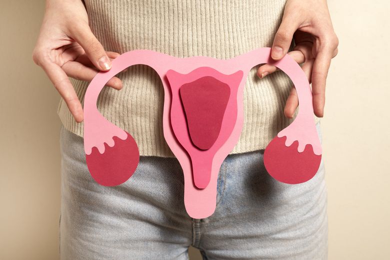 Cauze endometrioza