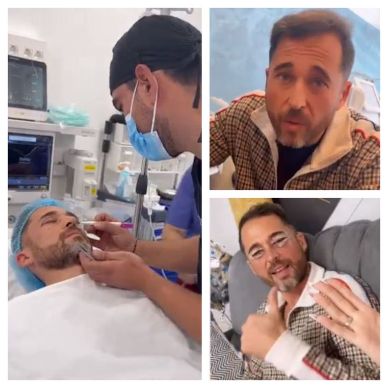 Dinu Maxer și-a făcut o operație estetică la nivelul feței. Soția lui a reușit să-l convingă: „Își asumă experiența!”