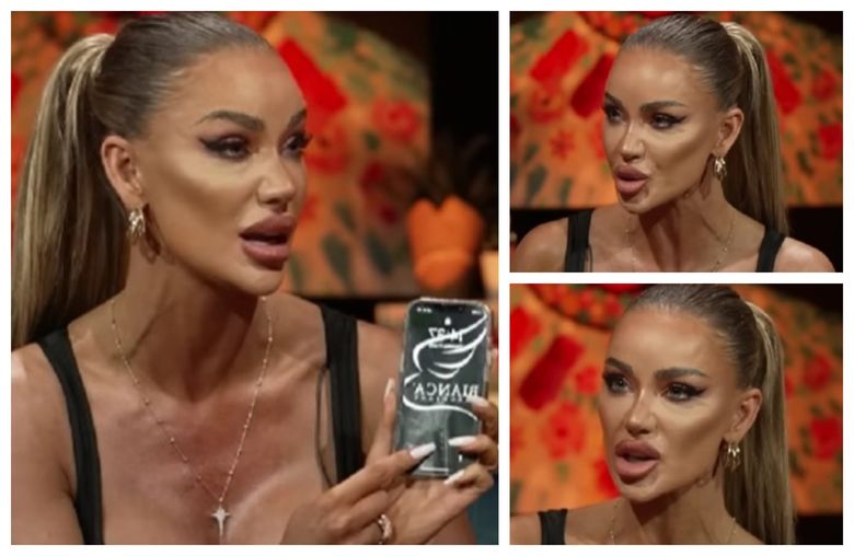 „Eu sunt foarte asumată.” Bianca Drăgușanu a răbufnit, în urma reproșurilor unor fani cu privire la buzelor ei prea mari